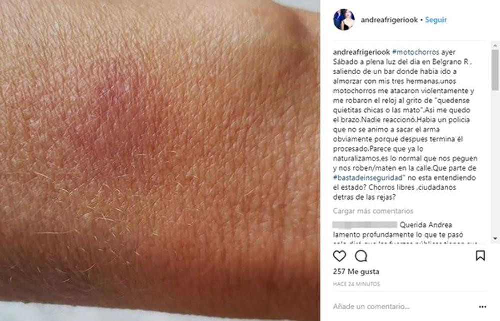 Andrea Frigerio - Ataque de motochorros - Instagram