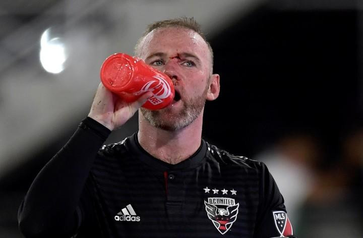 Rooney - MLS accidente 