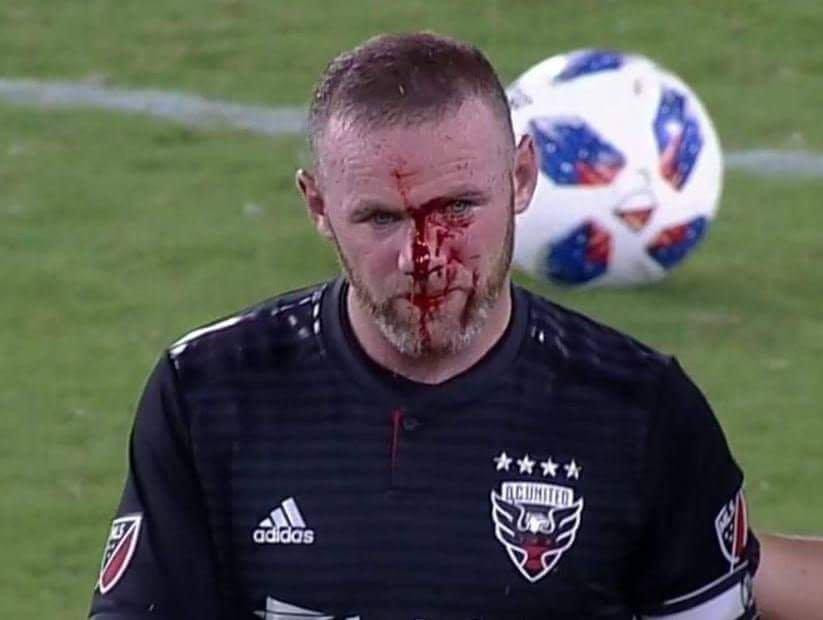 Rooney - MLS accidente
