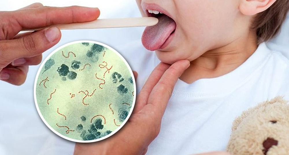 Estreptococo pyogenes - Bacteria - Salud - Medicina