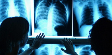 Efemérides del 8 de noviembre: Día Internacional de la Radiología