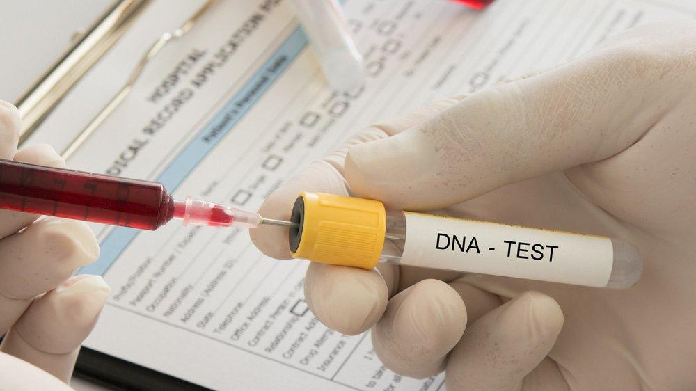 Test de ADN