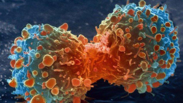 Cáncer: aseguran que el 95% de los tumores cancerígenos podrían curarse