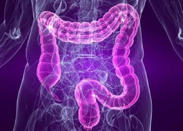Cáncer de colon: si se lo detecta a tiempo, 9 de cada 10 se podrían curar