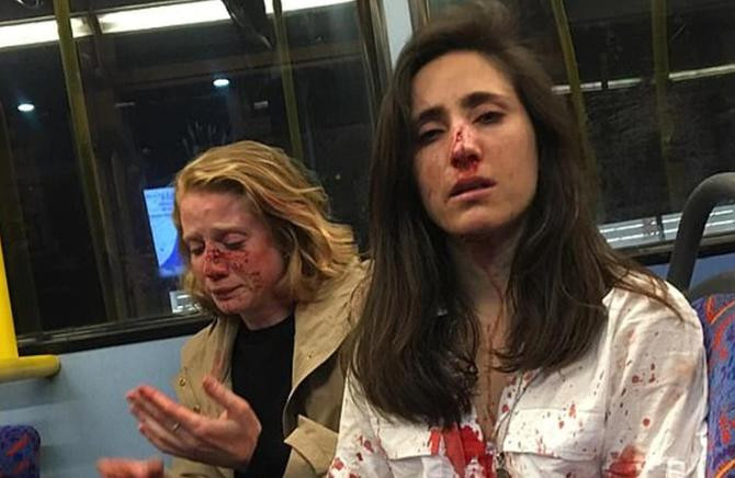 Azafata uruguay y novia agredidas en Londres 