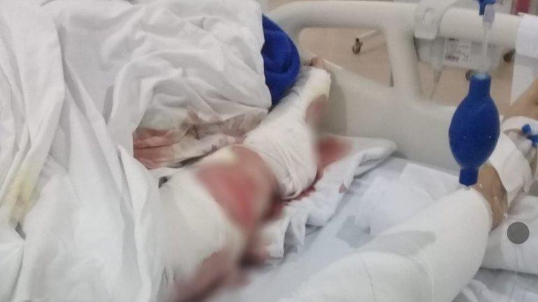 Mujer atacada por tres perros en Mar del Plata