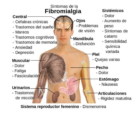 Fibromialgia, salud