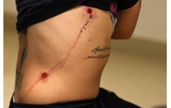 Heridas con bala de goma a Rocío Correa, jugadora de Selección Argentina