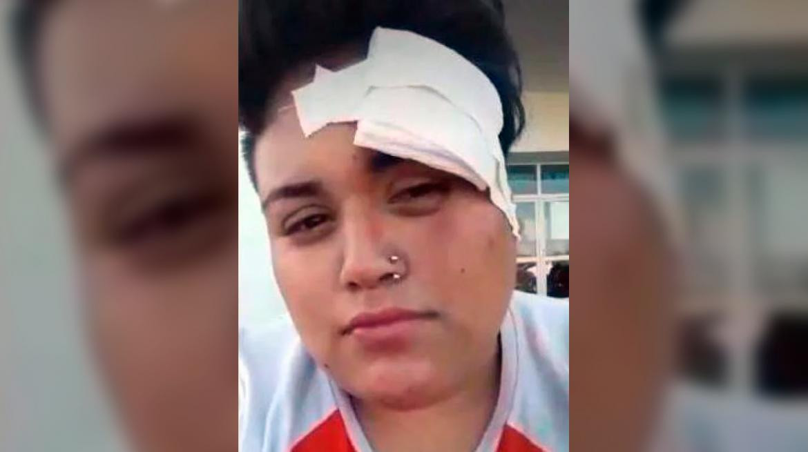 Mujer golpeada por patota, González Catán, violencia de género