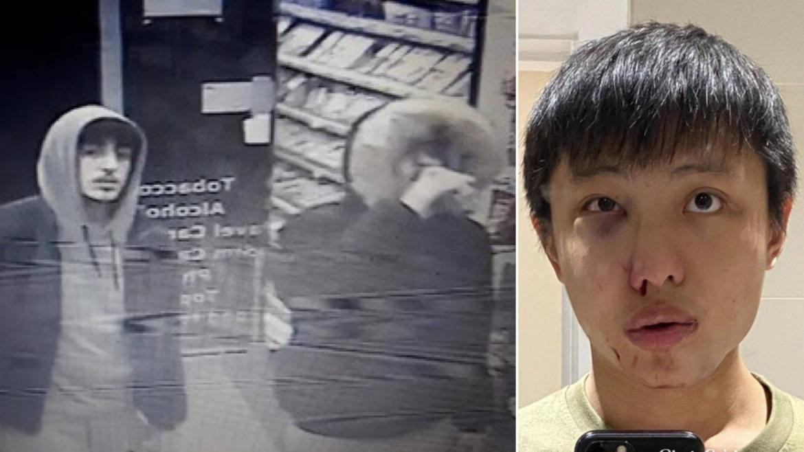 Jonathan Mok, joven asiático agredido en Gran Bretaña por discriminación por coronavirus