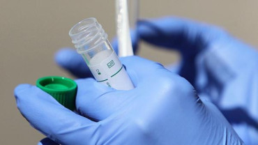 Coronavirus: Francia desarrolló un rápido e ingenioso test para detectar casos positivos