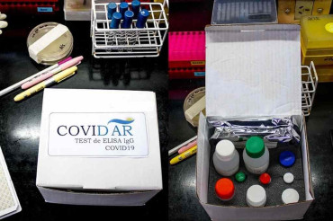 Coronavirus: ¿dónde y para qué se usan los tests desarrollados en la Argentina?