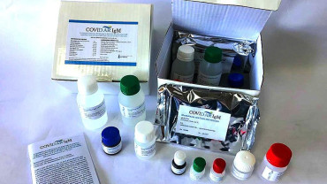 Coronavirus: aprobaron nuevo test serológico nacional y protocolo para medir anticuerpos en plasma convaleciente