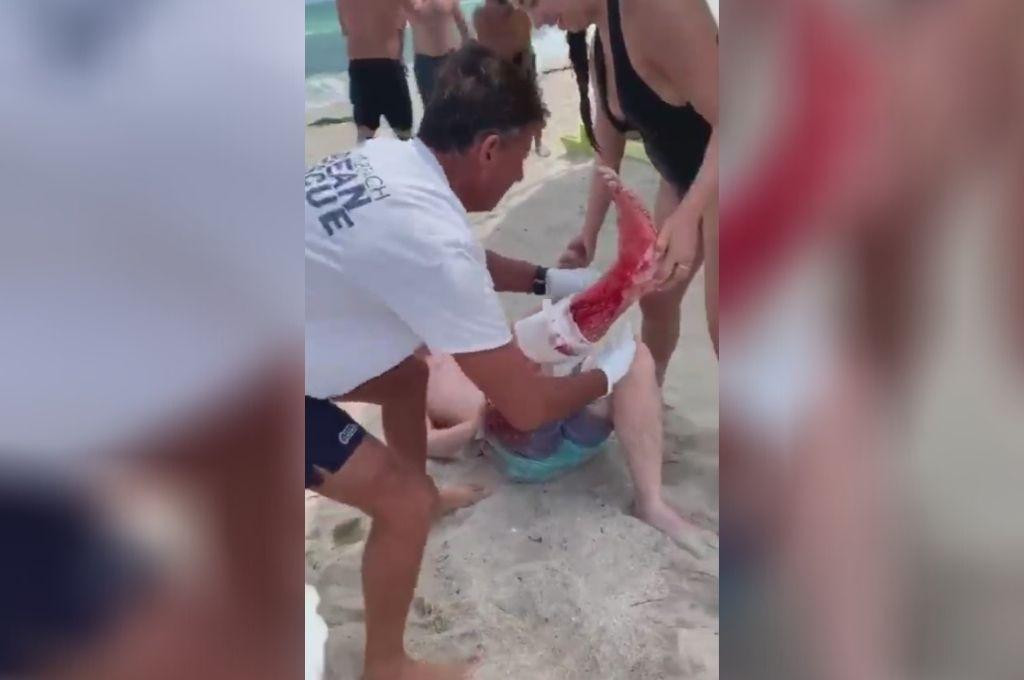 Estados Unidos, nadaba en South Beach cuando fue atacado por un tiburón que le hizo una grave herida