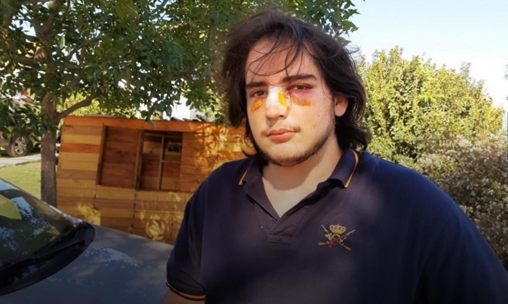 Ataque de rugbiers a un joven en Córdoba