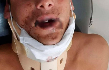 Brutal pelea de rugbiers terminó con un joven en terapia intensiva