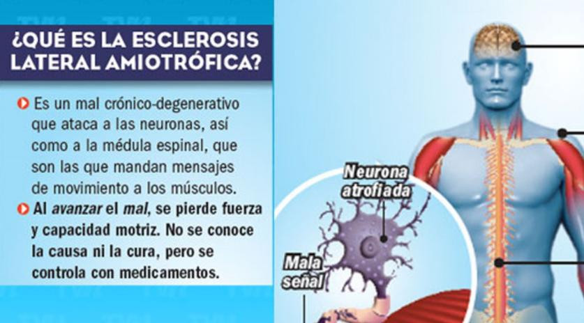 Esclerosis lateral amiotrófica (ELA), salud