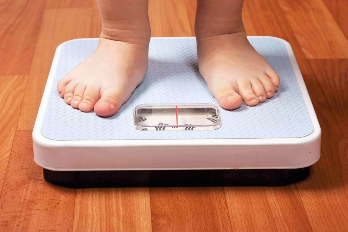 Obesidad infantil, sobrepeso en niños