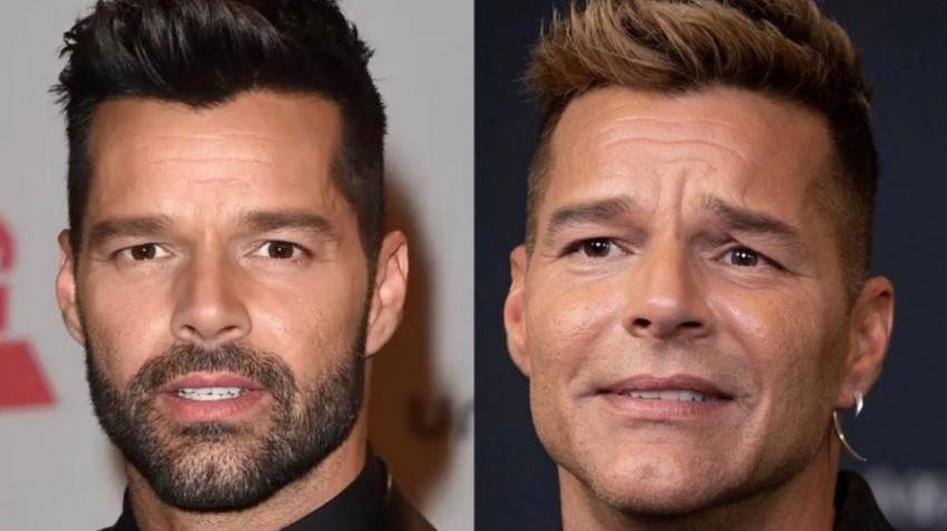 Ricky Martin, antes y después