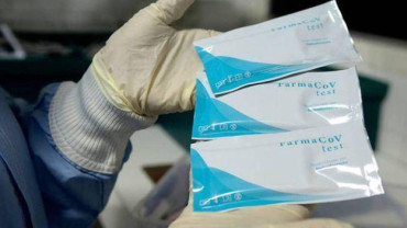 La Anmat aprobó test rápido de coronavirus: detecta anticuerpos en la fase temprana del virus