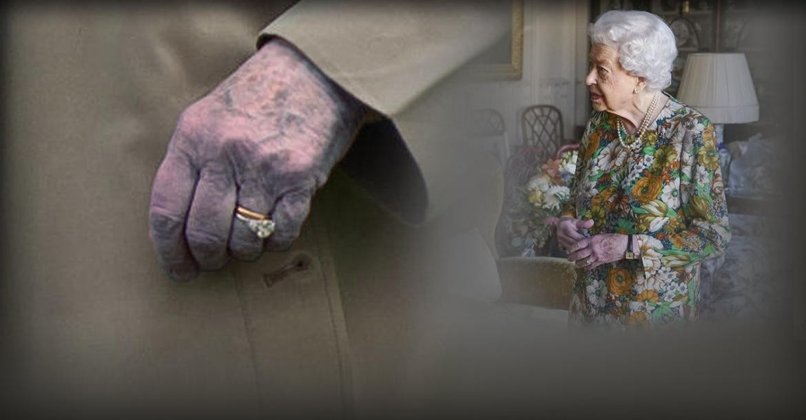 El misterio de las manos moradas de la reina Isabel II de Inglaterra