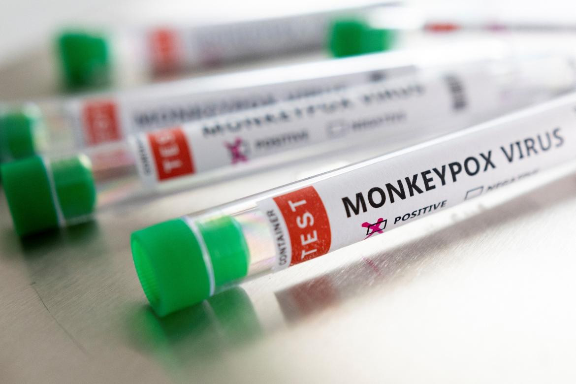 Test contra viruela del mono, Foto Reuters