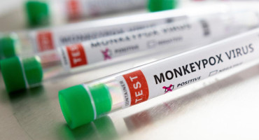 Desarrollan tres tests para detectar la viruela del mono