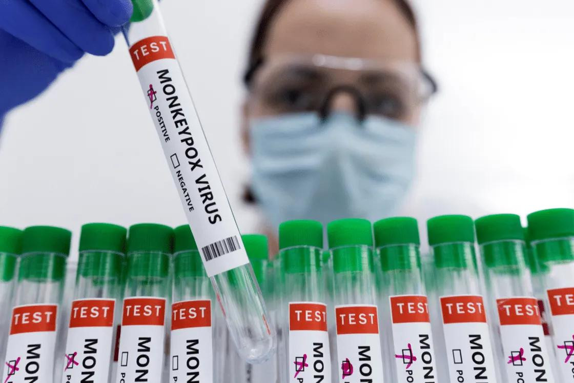 Vacuna contra viruela del mono. Foto: Reuters.