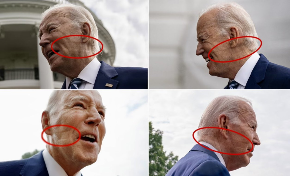 Marcas en la cara de Joe Biden. Fotos:  Twitter@judytgolf