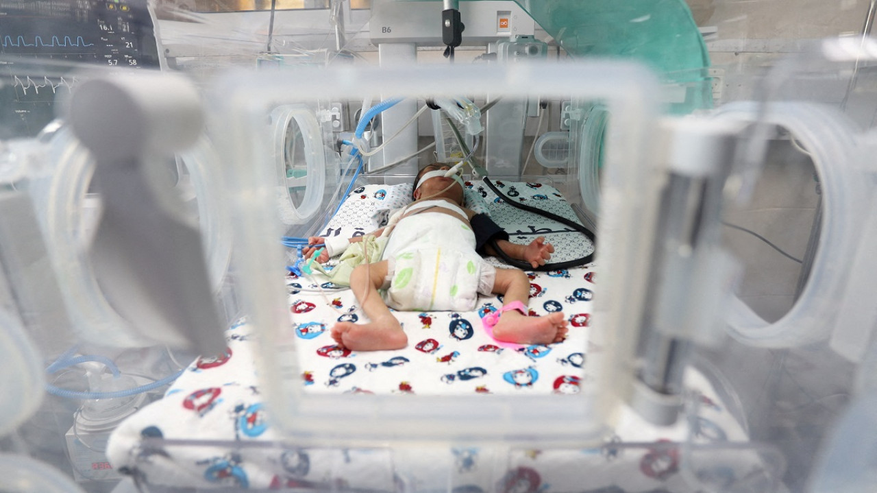 Un bebé prematuro en una incubadora. Foto: Reuters.