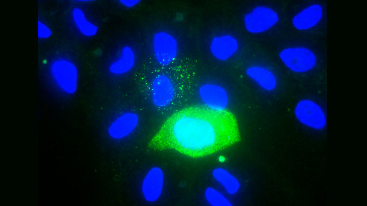 Inmunofluorescencia de células caninas infectadas. Foto: Danilo Bucafusco vía Conicet