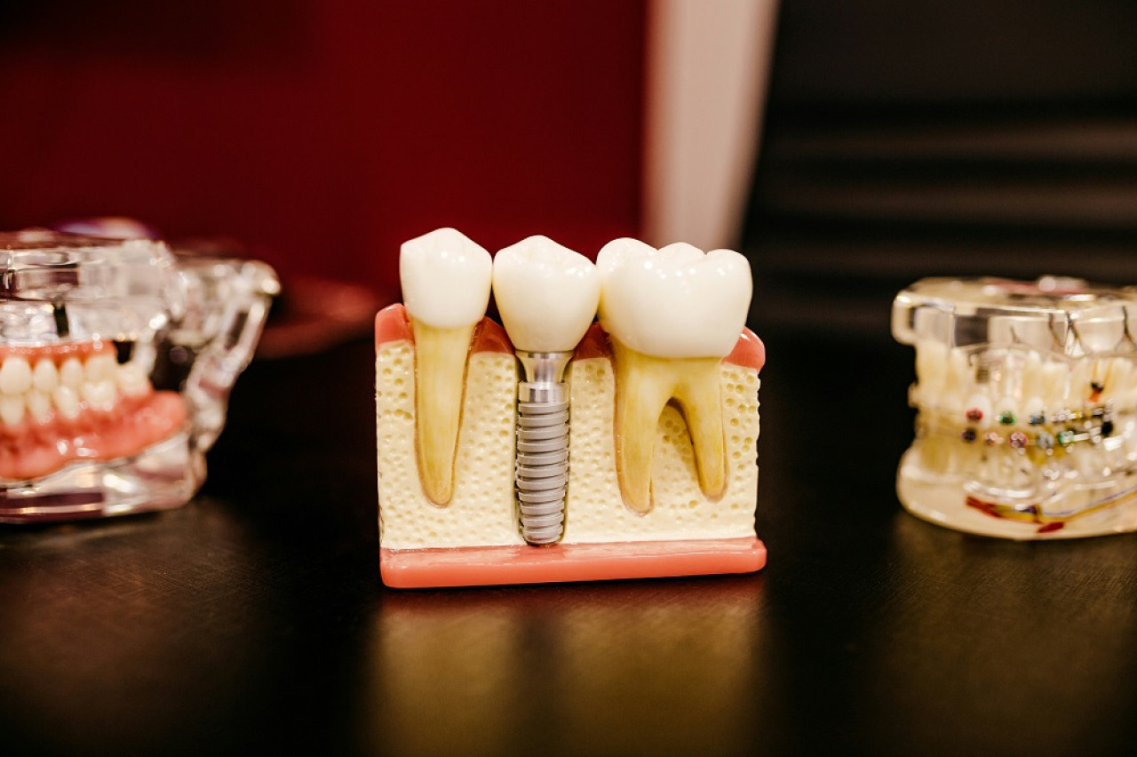 Odontología, dentista. Foto: Unsplash.