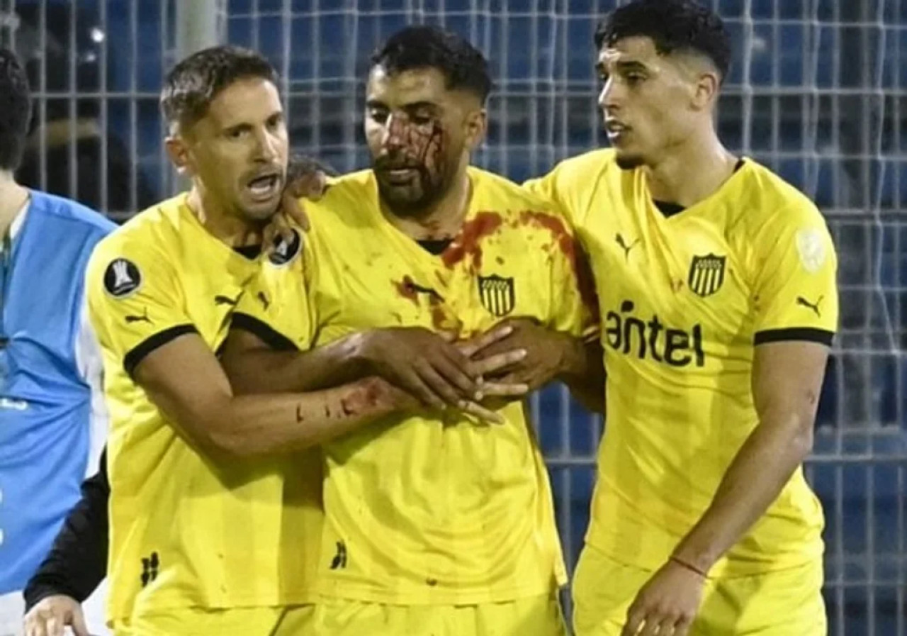 Un jugador de Peñarol fue agredido tras el partido ante Rosario Central. Foto: NA.
