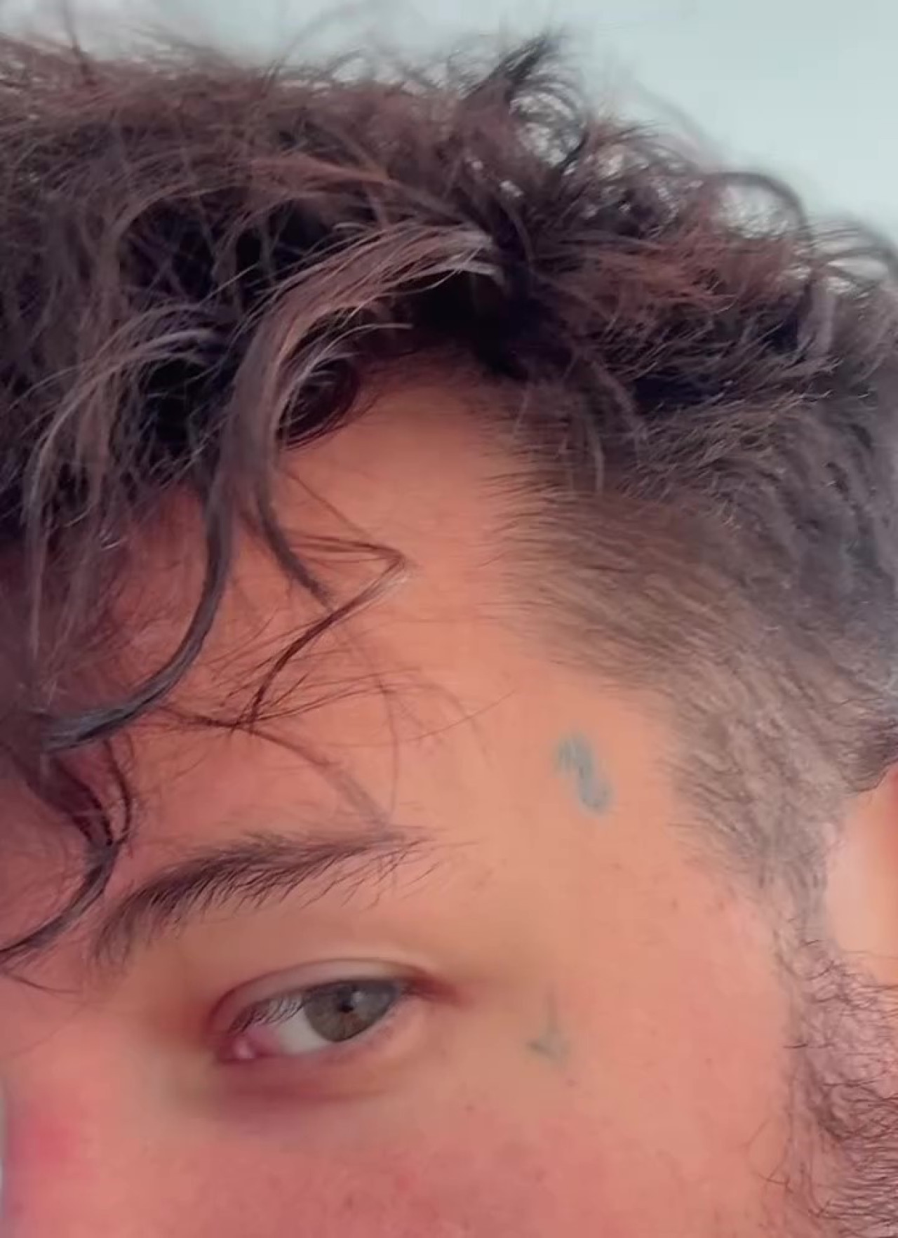 Alex Caniggia mostró como quedó su rostro tras borrarse los tatuajes. Foto: Captura de pantalla/Instagram